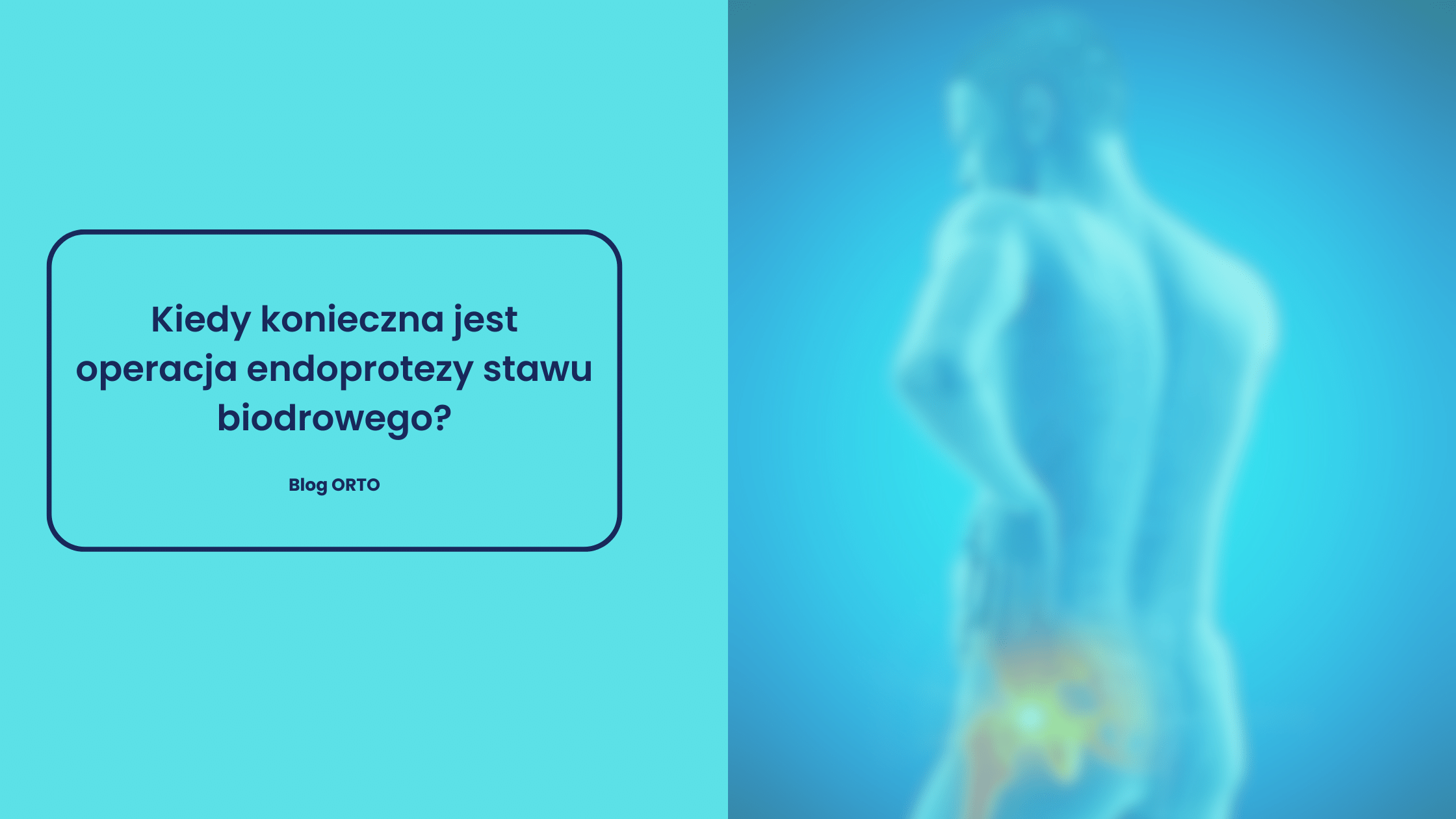 Kiedy konieczna jest operacja endoprotezy stawu biodrowego? - blog orto.pl