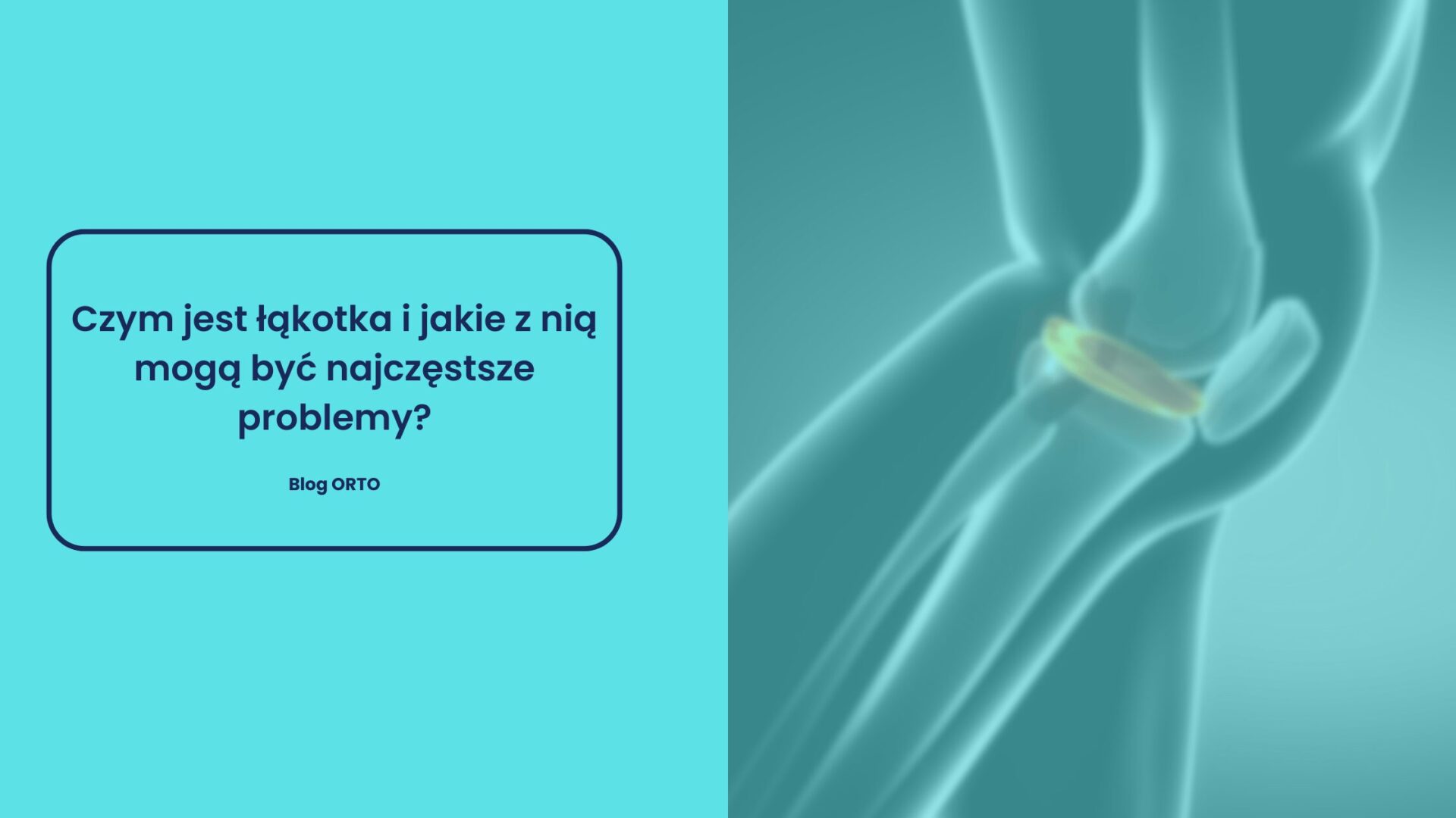 Czym jest łąkotka i jakie z nią mogą być najczęstsze problemy? - blog orto.pl