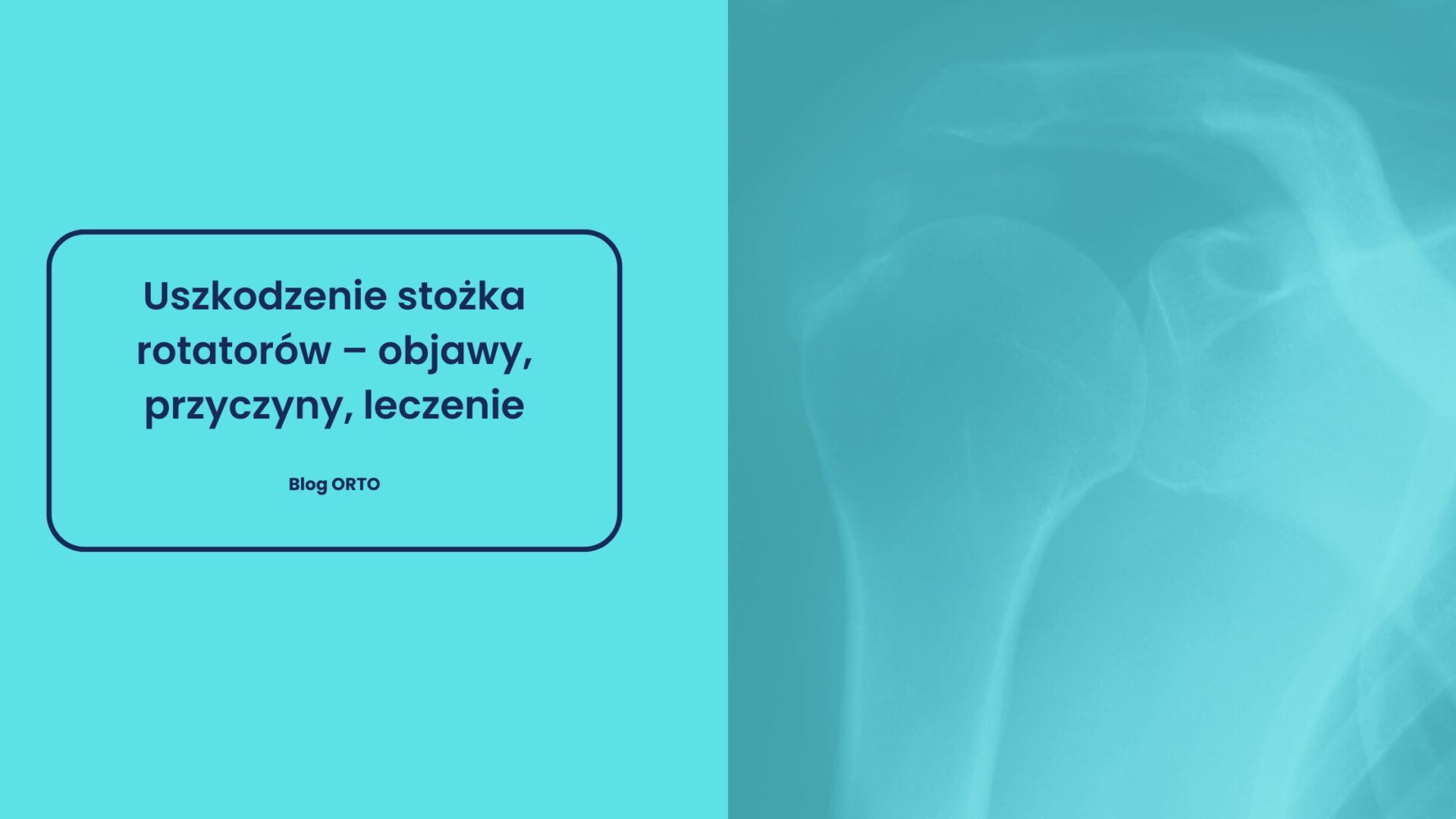 Uszkodzenie stożka rotatorów – objawy, przyczyny, leczenie