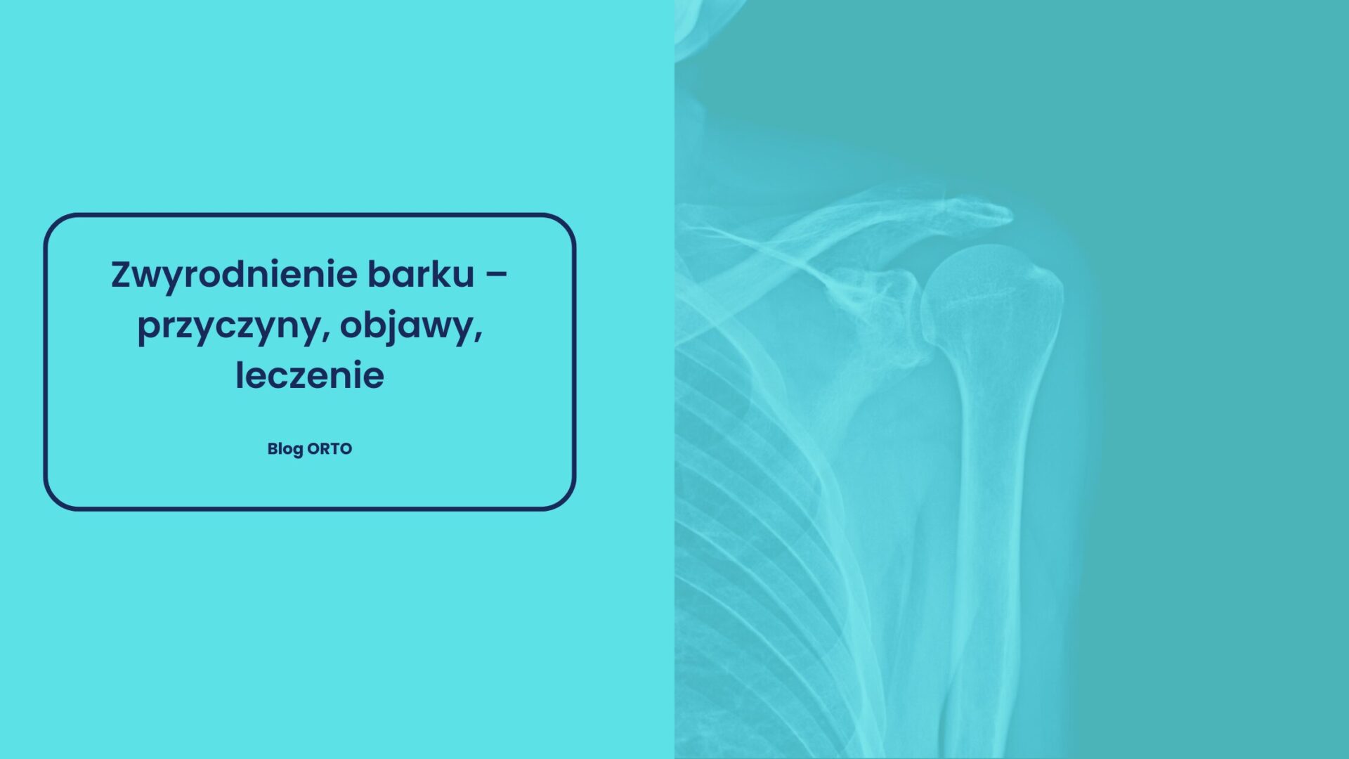 Zwyrodnienie barku – przyczyny, objawy, leczenie
