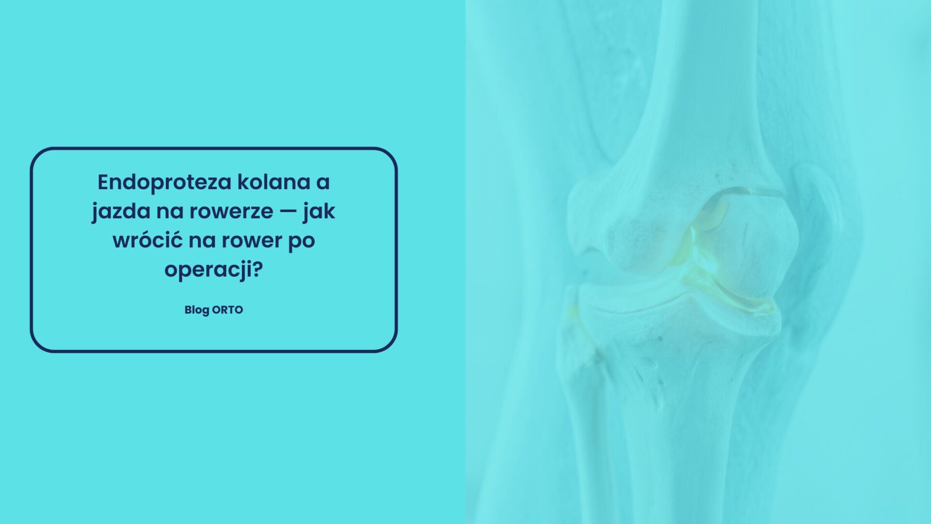 Endoproteza kolana a jazda na rowerze — jak wrócić na rower po operacji?