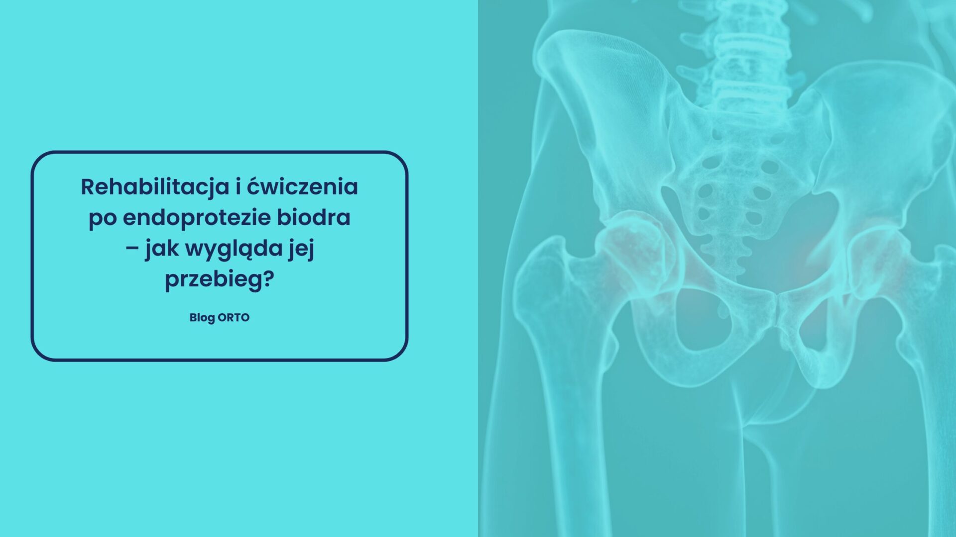 Rehabilitacja i ćwiczenia po endoprotezie biodra – jak wygląda jej przebieg?