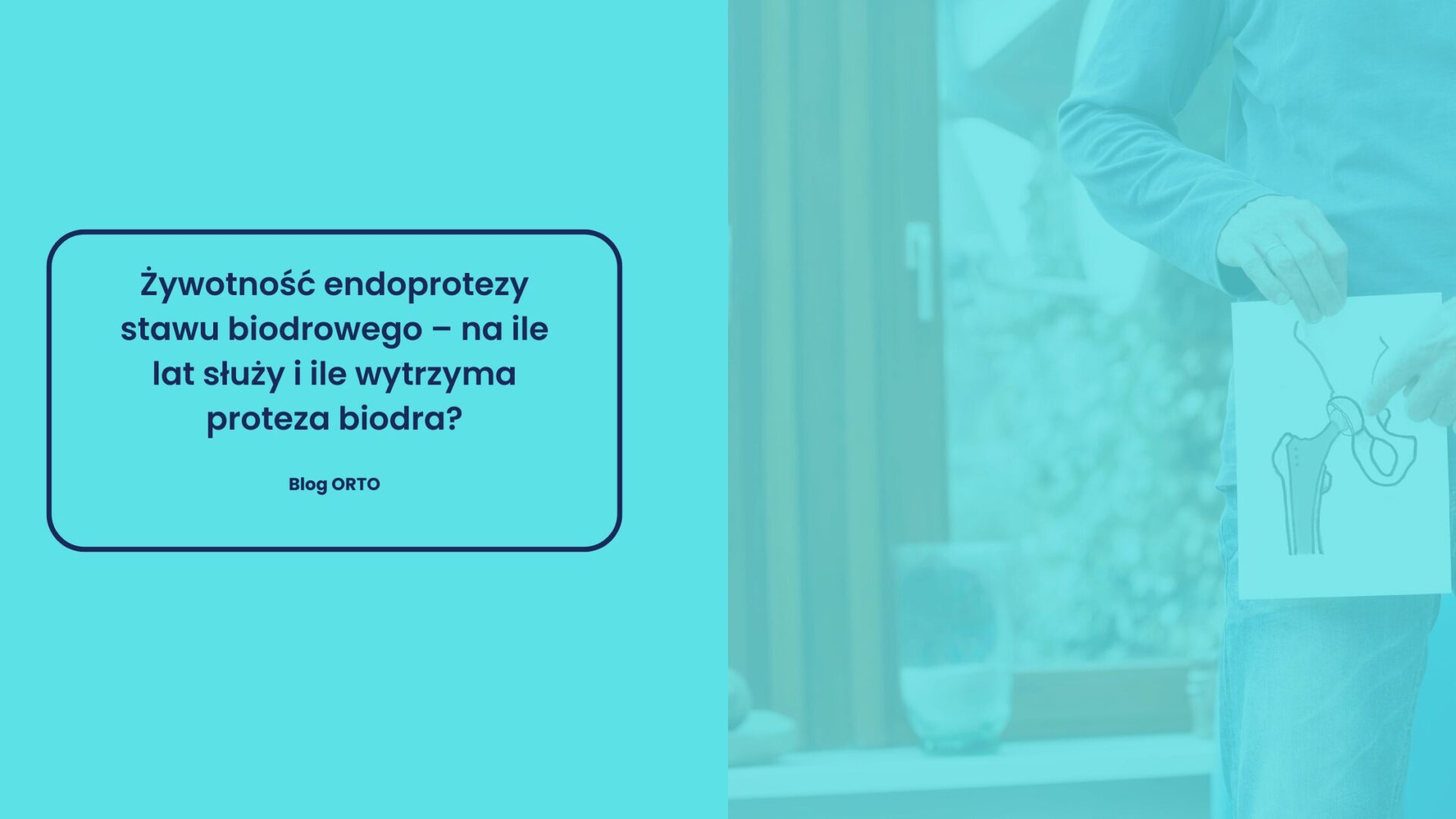 Żywotność endoprotezy stawu biodrowego – na ile lat służy i ile wytrzyma proteza biodra?